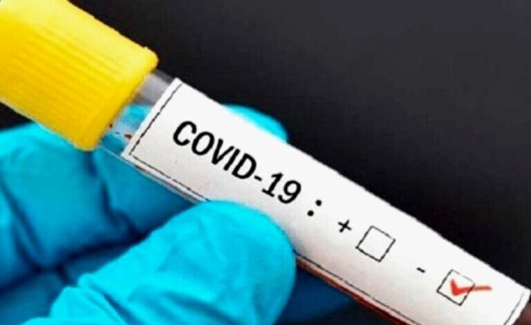 Photo of Se registraron 1.208 nuevos casos de coronavirus en todo el país