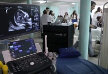 Photo of La provincia presentó la Unidad de Medicina Fetal de Hospital Cullen